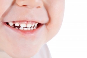 Los dientes de leche son más blancos que los permanentes.