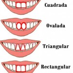 forma de los dientes