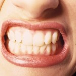 Clínica Dental Luján Navas - Tipos de Mordida