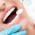 Diferencia entre gingivitis y periodontitis