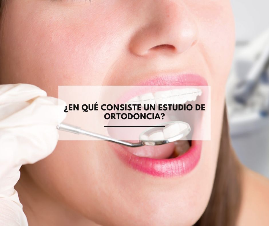 ¿En qué consiste un estudio de ortodoncia?